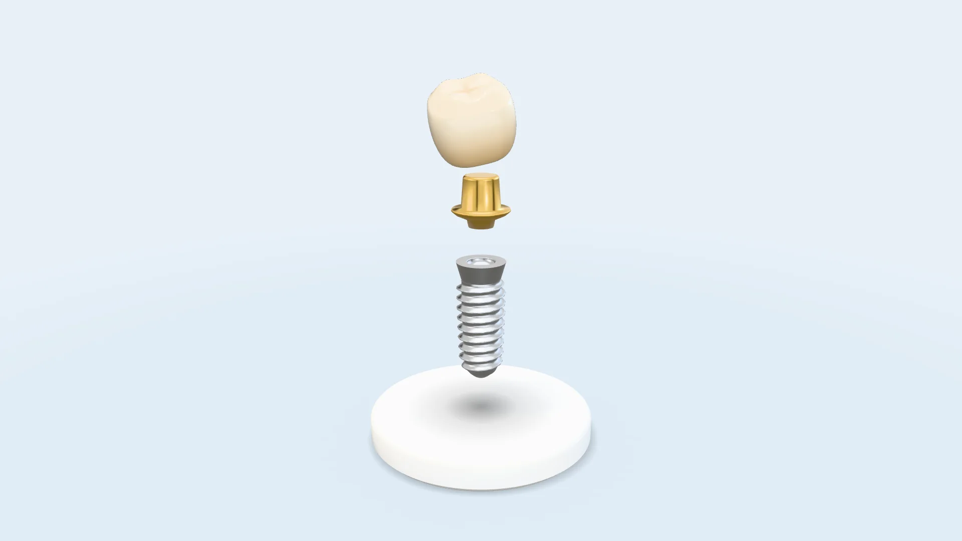 Mão sứ trắng ngà nhấc nhẹ khỏi khớp nối vàng nhạt và trụ titan ren xoắn, đứng trên bệ tròn trắng trước phông trắng xanh