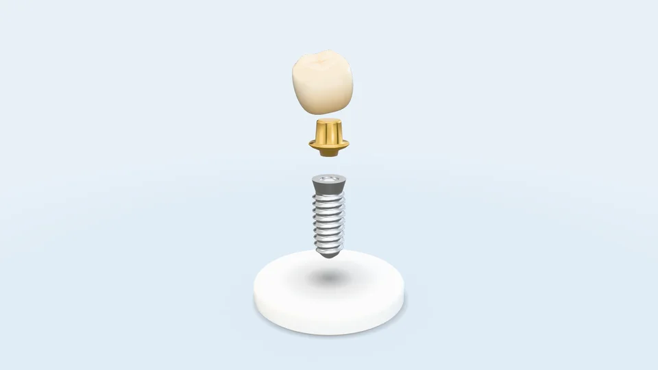 Nha khoa Thanh Vân — Trồng răng implant, mẫu website Y tế